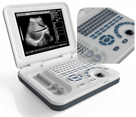 Multifunction Portable Human Ultrasound Machine DRF Real Time ISO