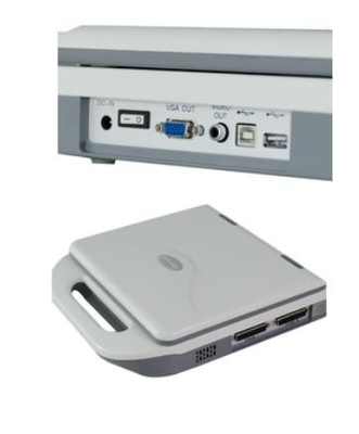 Digital Portable OB Gynecology Ultrasound Machine 12.1in LED 128 Images Storage
