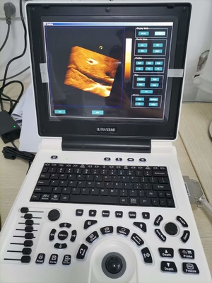 Xianfeng Pregnancy Color Doppler Ultrasound Machines Images 4B OEM
