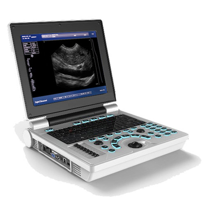 12 Inch BB USG Laptop Ultrasound Machines Scanner mobile Li Battery