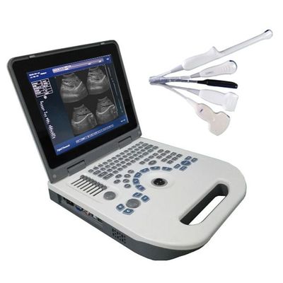 Quality  TGC Control Notebook Ultrasound Scanner For Pregnancy Home Use factory