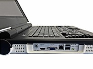 15 Inch LED Color Portable Ultrasound Machine with 60deg Scan Angle and Configuration Probe 2.0MHz-5.0MHz