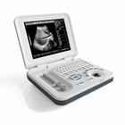 15 Inch LED Color Portable Ultrasound Machine with 60deg Scan Angle and 8 TGC Control