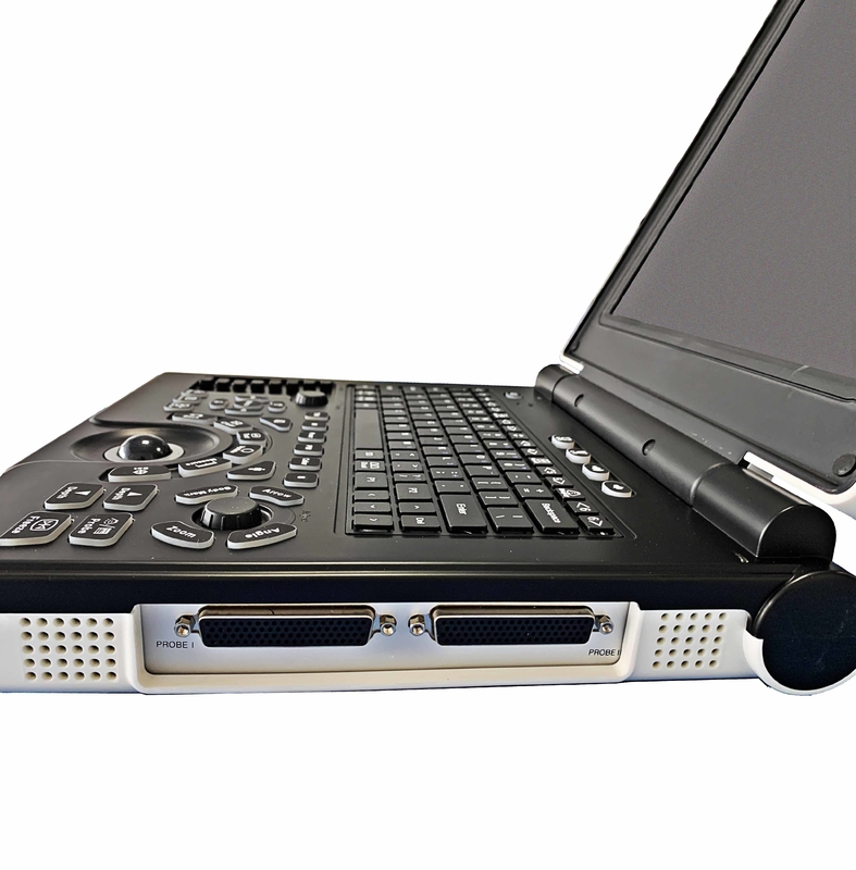 ISO Basic Level Portable USG Machine Digital Color Doppler Ultrasound System