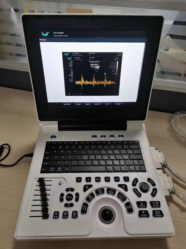 Xianfeng Pregnancy Color Doppler Ultrasound Machines Images 4B OEM