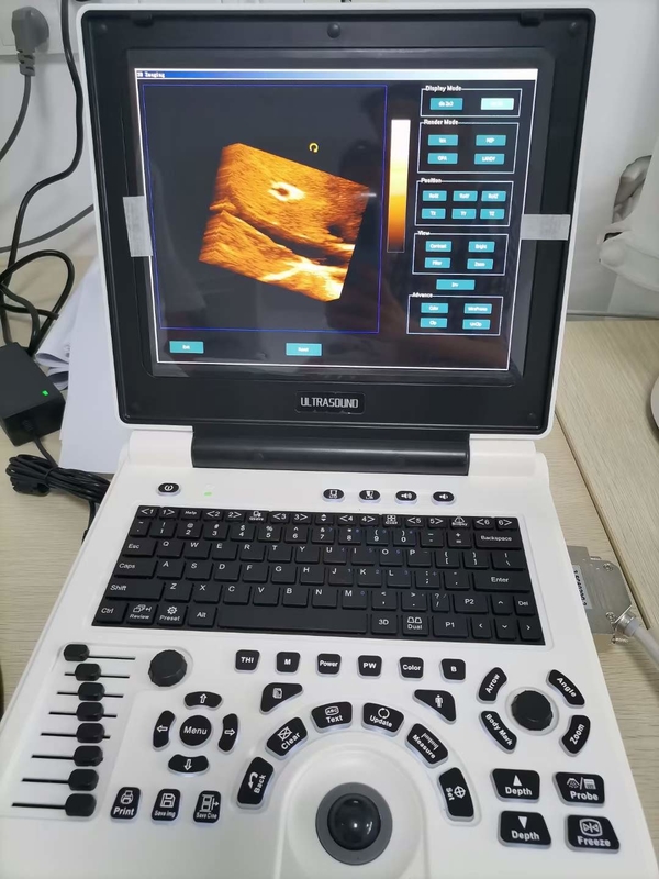Xianfeng Pregnancy Color Doppler Ultrasound Machines Images 4B OEM