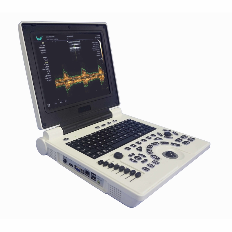 Xianfeng Pregnancy Color Doppler Ultrasound Machines Images 4B OEM