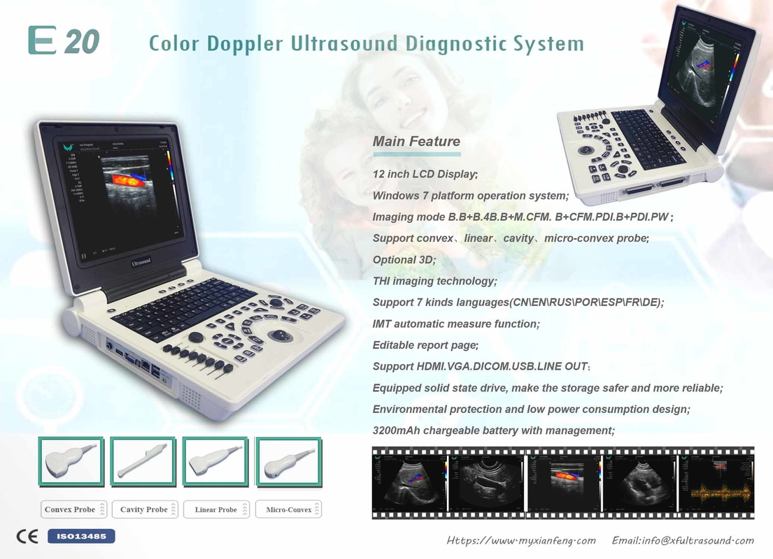 ISO Basic Level Portable USG Machine Digital Color Doppler Ultrasound System