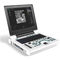 DICOM Portable 3D Doppler Ultrasound Equipment Doppler Medical Instrument 64G