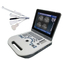 TGC Control Notebook Scanner Laptop Ultrasound Machine For Pregnancy Home