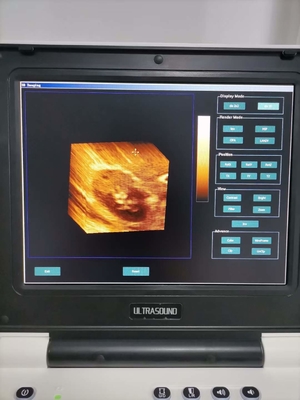 3D 4D Echography Portable USG Machine For Gynecology Eco