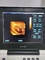 PW Ophthalmic Ultrasound Portable USG Machine Ultrasonography Machine