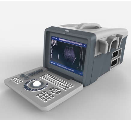 Xianfeng Durable Ultrasound B Scan Machine For Pregnancy With Two Probe Sockets