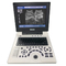 Hospital Laptop Portable USG Machine Portable Ultrasound Machines USS Scanner