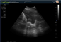 Medical Home Pregnancy Ultrasound Machine DRF RDA Imaging USB Port
