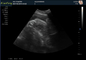 Medical Home Pregnancy Ultrasound Machine DRF RDA Imaging USB Port