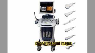 Doppler Ultrasound Scanner PW CFM PDI Mode