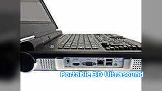 Portable Ultrasound E20 Clinical Hospital