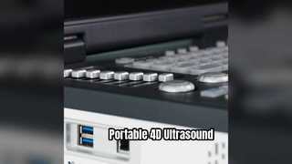 Portable 4D Doppler Ultrasound Machine ICU Ready