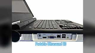Portable Color Doppler Ultrasound E0 Urology Scan