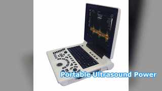 Portable Ultrasound Machine OB GYN Diagnosis