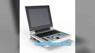 Portable Ultrasound System . Inch Li Battery